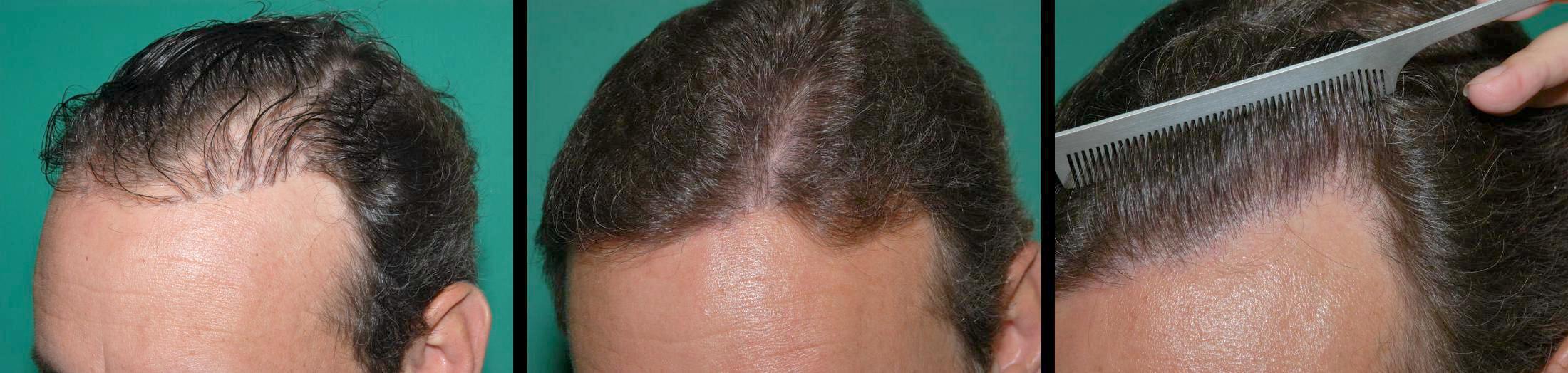 PLUG_REPAIR.jpg PLUG_REPAIR.jpg